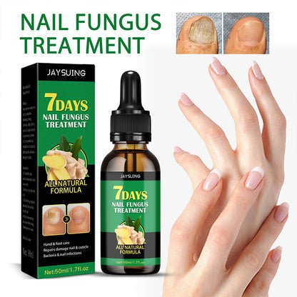 7 Days Ginger Nail Fungal Treatment