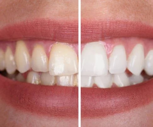 Max Whitening Purple Toothpaste